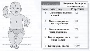 Билирубин у новорожденного ребенка. Физиологическая желтуха